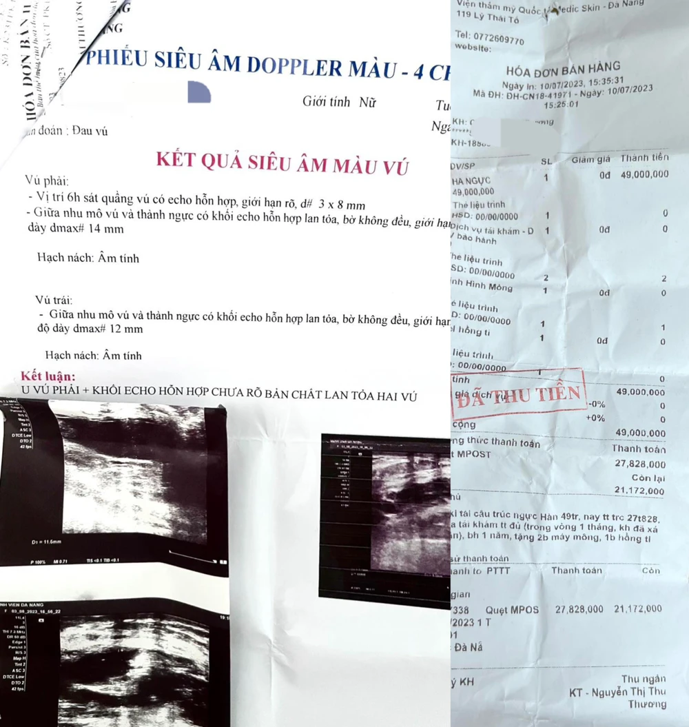 Chị T bị kết luận u vú sau khi thực hiện gói Tái cấu trúc ngực Hàn của Medic Skin. Ảnh: MT