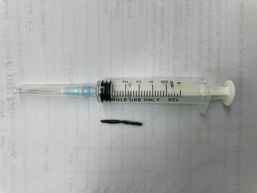 Dị vật lấy ra từ tim bệnh nhân. Ảnh: BVCC