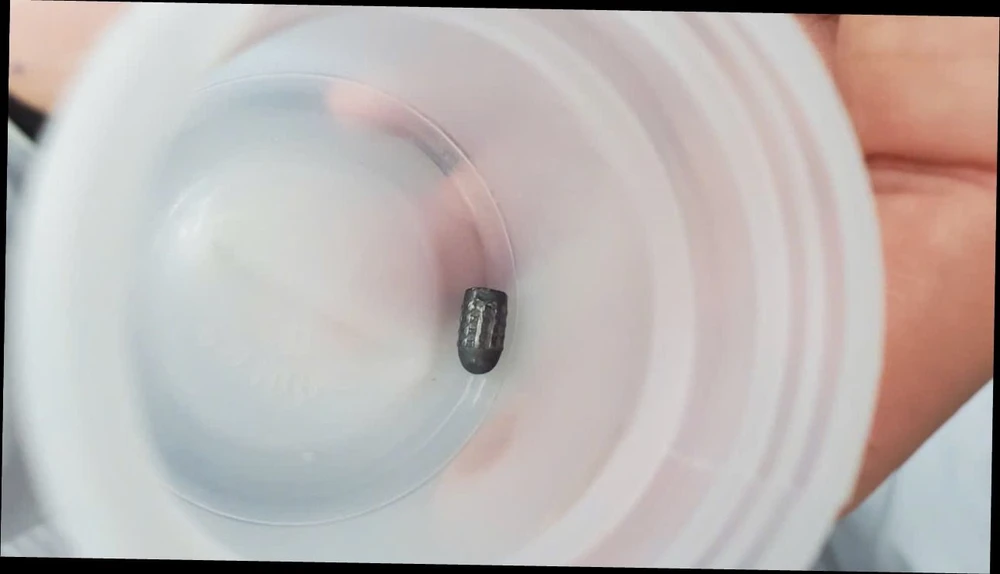 đạn lạc bắn vào đầu