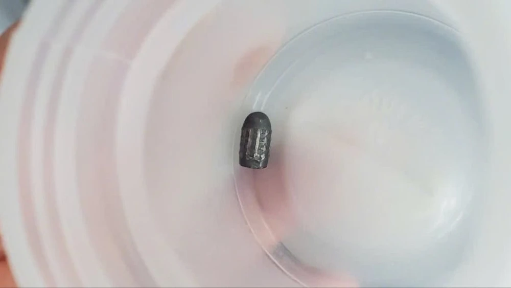 người dùng súng hơi bắn chim khiến đạn lạc trúng đầu phụ nữ đang làm vườn