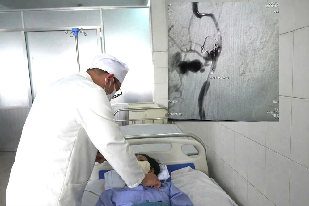 cần thơ,ung thư vòm hầu,can thiệp nội mạch,xuất huyết