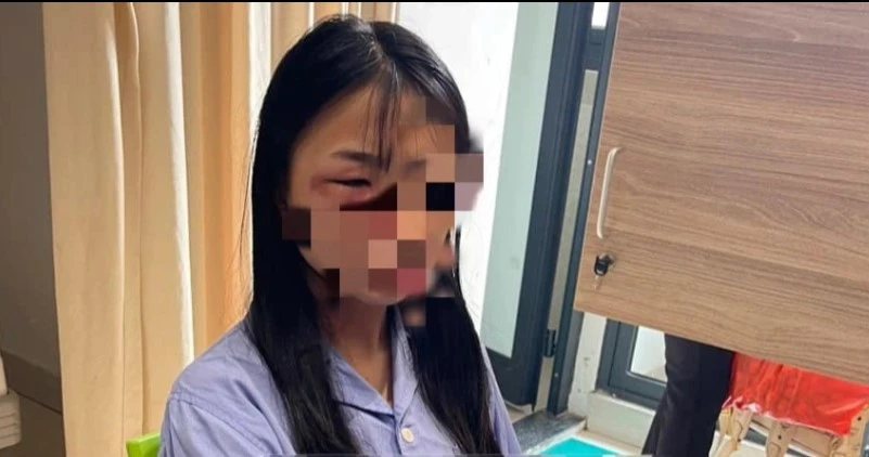 Nạn nhân trong vụ bị đánh hội đồng. Ảnh:CQCC Nạn nhân trong vụ bị đánh hội đồng. Ảnh:CQCC