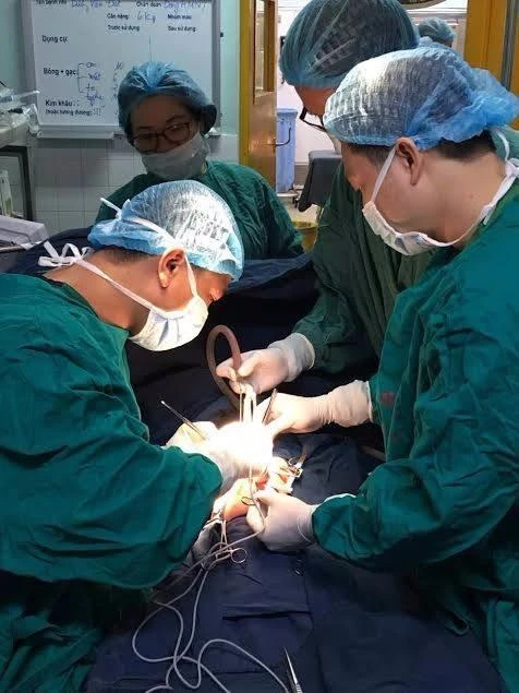 Bác sĩ BV Nhi trung ương đang phẫu thuật cứu sống bệnh nhi.