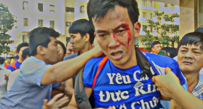 TP.HCM: Cư dân chung cư lại bị tấn công đổ máu ảnh 2