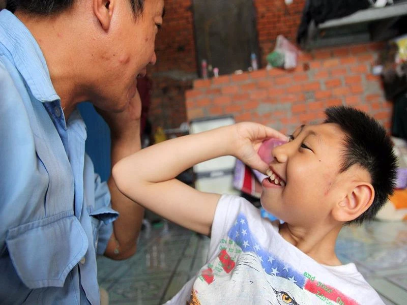 cha có con bại não