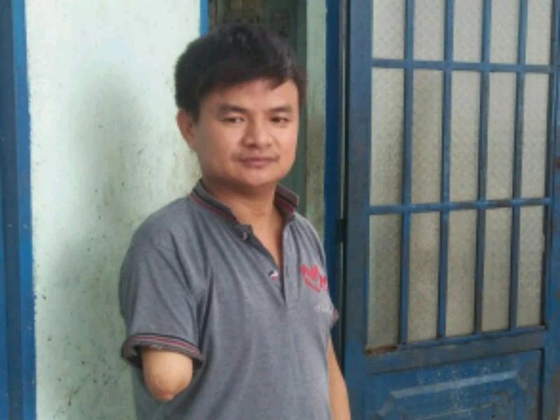 Người lao động bị mất 1 cánh tay 