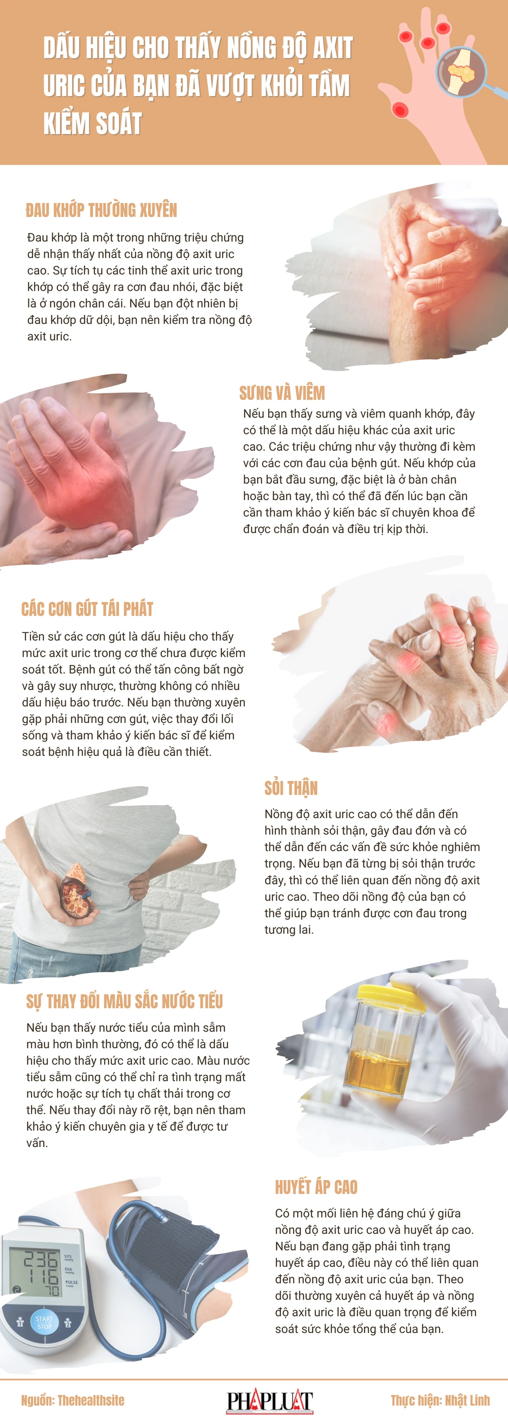 Dấu hiệu cho thấy nồng độ axit uric của bạn đã vượt khỏi tầm kiểm soát