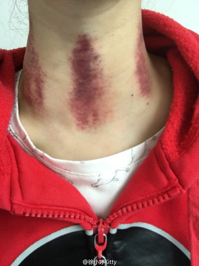 Nữ diễn viên trẻ Trung Quốc Xu Ting.