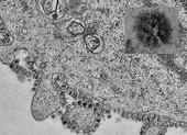 Hình ảnh hiển vi đầu tiên về cách thức virus Corona phân bào