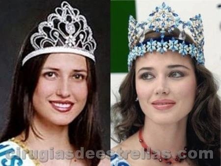 Maju Mantilla trước và sau khi đăng quang Hoa hậu Thế giới 2004. Một bác sĩ phẫu thuật thẩm mỹ người Peru từng tiết lộ cô đã nhờ đến dao kéo để gương mặt trở nên thanh thoát, quyến rũ hơn.