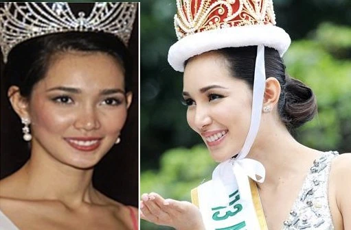 So với hình ảnh quá khứ, đương kim Hoa hậu Quốc tế Bea Rose Santiago có thể đã phẫu thuật nâng mũi để gương mặt hoàn hảo hơn.