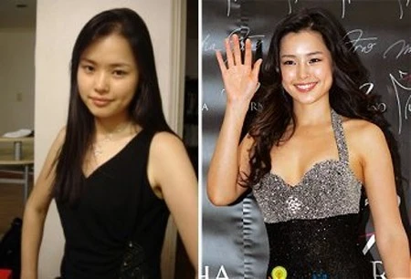 Á hậu 3Miss Universe 2007, người đẹp Hàn Quốc Honey Lee, thời quê mùa (ảnh trái) và sau khi tham dự cuộc thiHoa hậu Hoàn vũ.