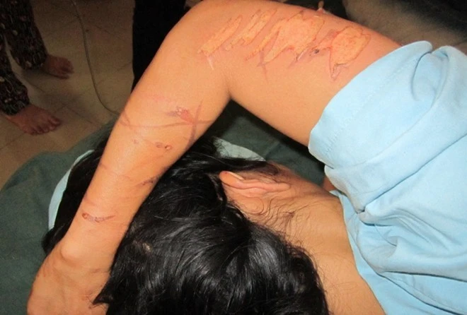 Chị kết bị tra tấn hết sức dã man. 