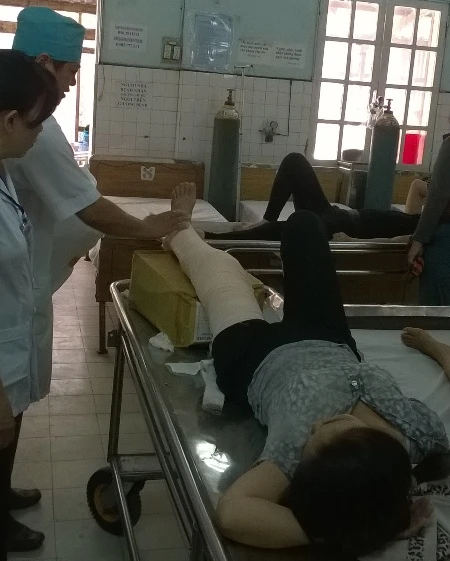 Chị Huệ bị cây phường đè gãy chân