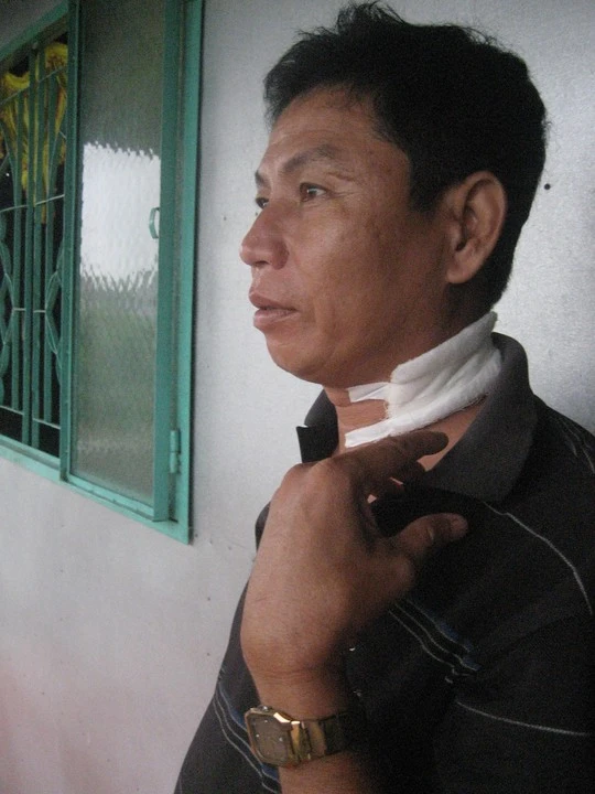 Ông Mai Hoàng đang kể lại việc mình bị chém vào cổ 