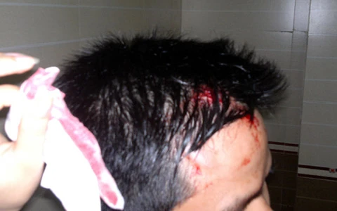 Nguyệt Long; karaoke; hà Tĩnh; hành hung Nguyệt Long; karaoke; hà Tĩnh; hành hung