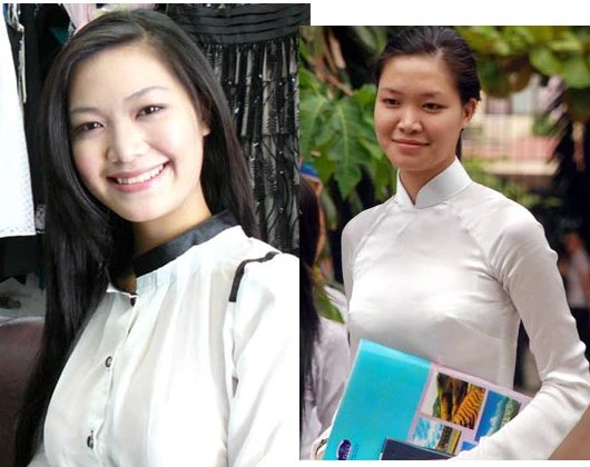 Hoa hậu, Mai Phương Thúy, cơ thể bất thường