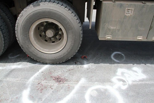 Bé trai bảy tuổi bị xe container cán nát chân ảnh 2