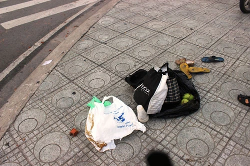 Người phụ nữ nhập viện, nghi do hai tên cướp tông xe ảnh 2