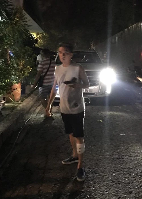 mr-dam-khau-6-mui-o-chan-vi-bi-tai-nan-khi-tap-liveshow-6