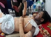 Bỏng nặng do điện giật, một người nhập viện nguy kịch