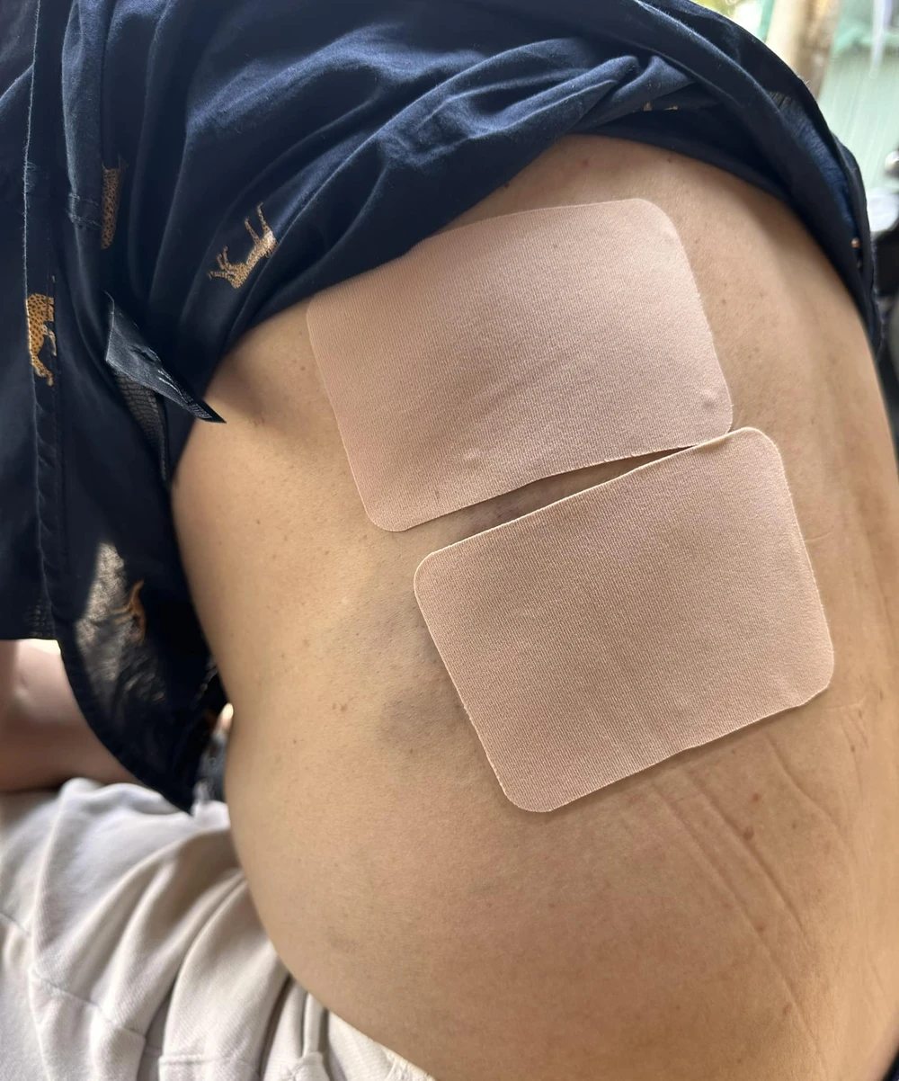 Nghệ sĩ Tấn Beo bị chấn thương vì ngã cầu thang. Ảnh: FBNV