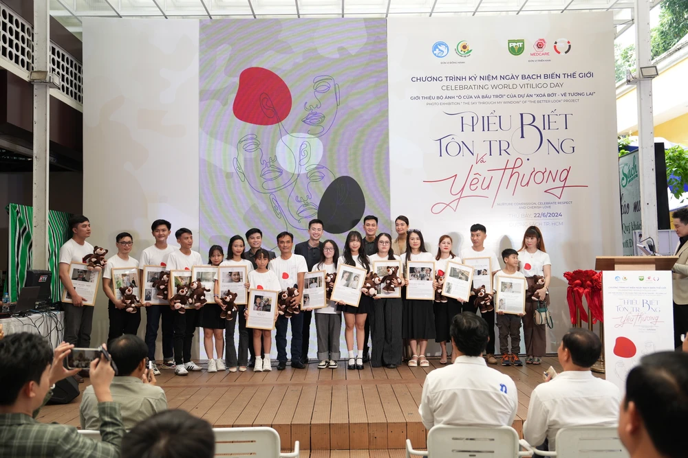 Bệnh Bạch biến