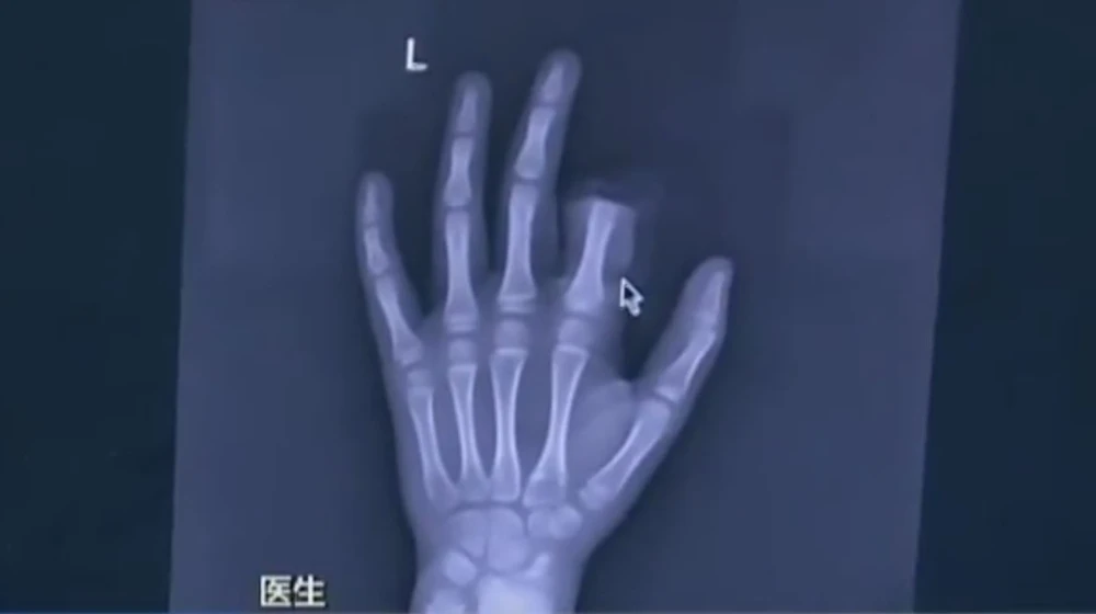 tu-cat-ngon-tay-vi-bi-cam-xai-smartphone