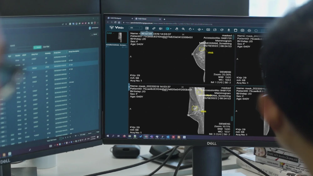 Sản phẩm AI VinDr đạt chứng nhận của FDA.