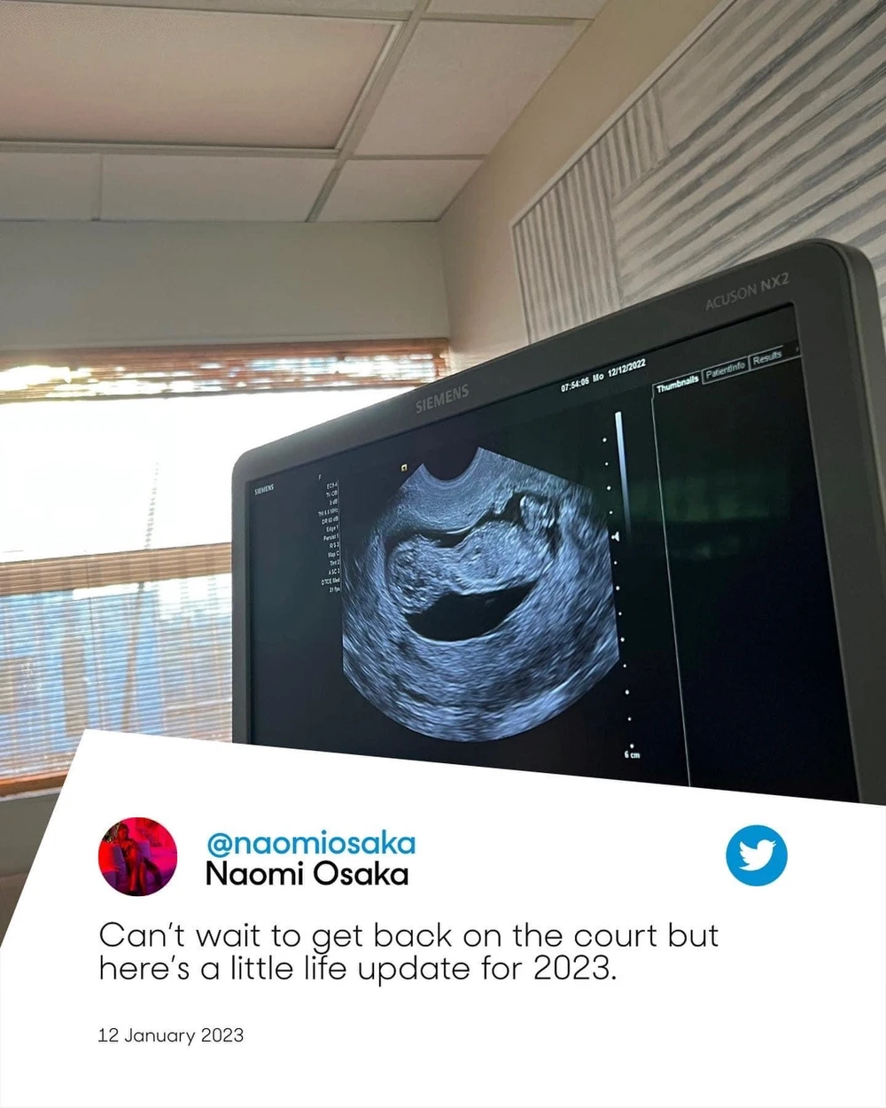 Tay vợt người Nhật Bản chia sẻ tin vui với người hâm mộ trên mạng xã hội.