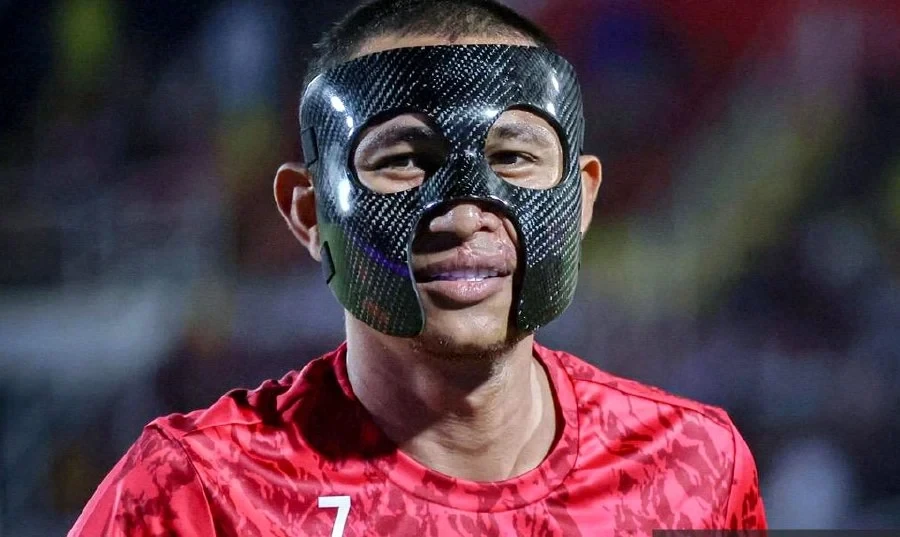 cầu thủ Faisal Halim bị tấn công bằng acid