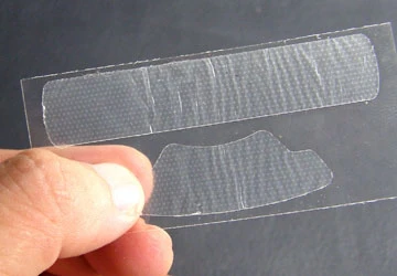 Răng trắng thì nướu... chẳng còn! ảnh 1