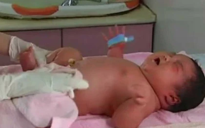 Những em bé sơ sinh nặng nhất thế giới ảnh 5