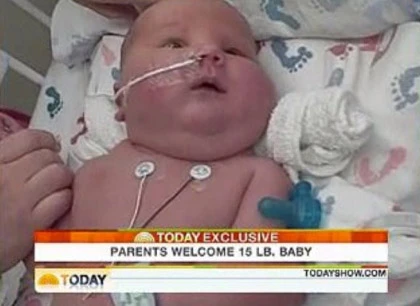 Những em bé sơ sinh nặng nhất thế giới ảnh 4