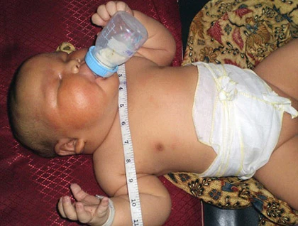 Những em bé sơ sinh nặng nhất thế giới ảnh 1