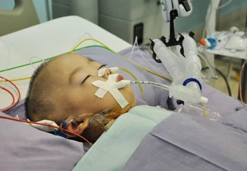 Bác sĩ Việt tách rời thành công trẻ song sinh ảnh 2