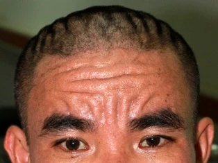 Phát hiện ca bệnh lạ về da đầu tiên trên thế giới ảnh 1