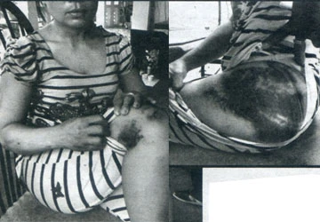 Đánh vợ dã man, chỉ bị phạt 700.000 đồng ảnh 1