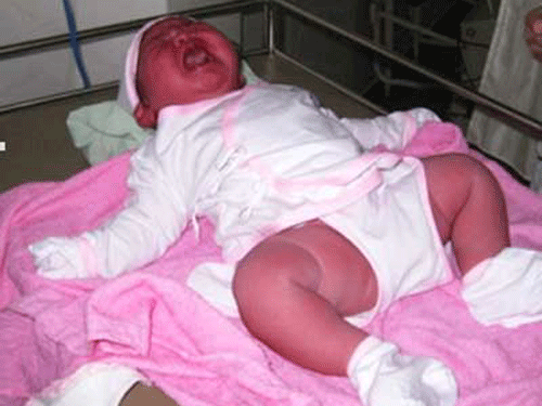 Bé gái sơ sinh nặng 6kg ảnh 1