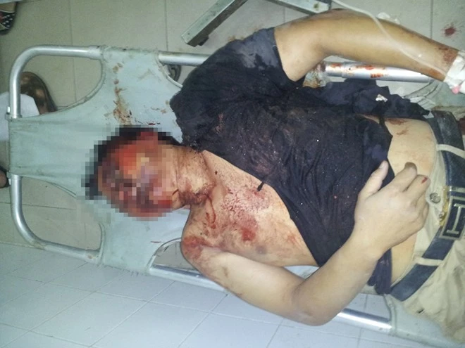 Bị dân vây đánh tới biến dạng vì trộm gỗ quý ở 'làng tỷ phú' ảnh 1