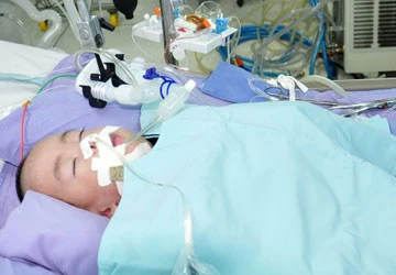 Bác sĩ Việt tách rời thành công trẻ song sinh ảnh 3