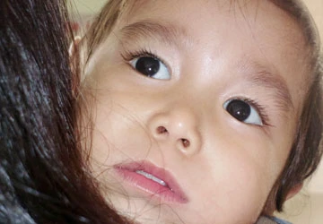 Cháu bé bị mù, liệt do thuốc gây mê ảnh 1