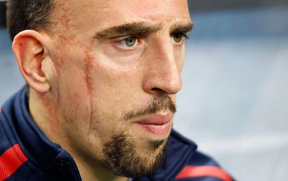 Franck Ribery: Quả bóng vàng không cần vết sẹo ảnh 1