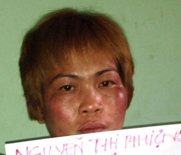 Bắt “nữ quái” cầm đầu nhóm dàn cảnh va chạm để trộm ảnh 1