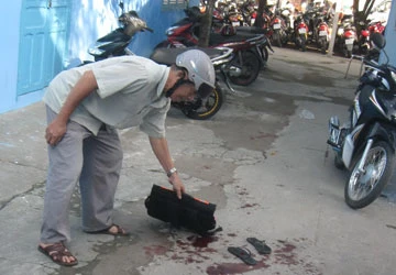 Chú đâm cháu trọng thương ảnh 1