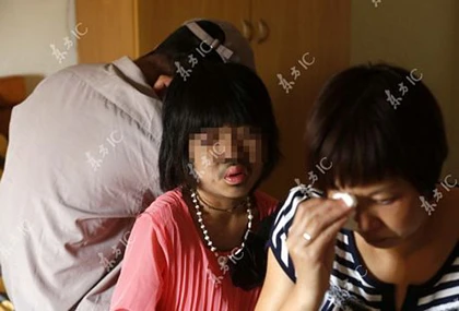 Lông mọc khắp cơ thể bé gái 9 tuổi ảnh 6