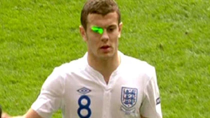 Cầu thủ Anh bị chiếu đèn laser ảnh 1 Cầu thủ Anh bị chiếu đèn laser ảnh 1