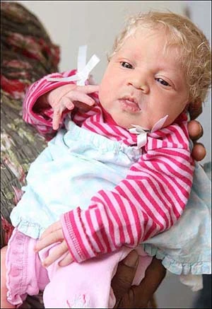 Kỳ lạ chuyện cha mẹ da đen sinh con da trắng ảnh 1