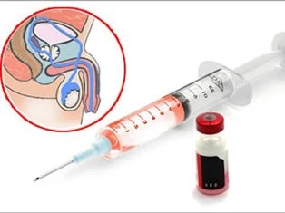 Thêm một số nước “thiến” tội phạm tình dục ảnh 1