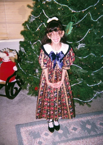 Cô gái "xấu xí nhất thế giới" mơ làm diễn giả ảnh 4